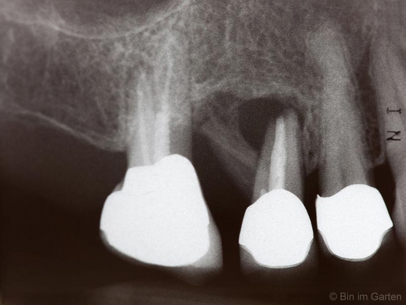 Endodontologie